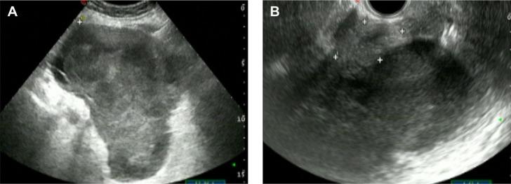 https://cdn.ncbi.nlm.nih.gov/pmc/blobs/6c0d/4321664/541b3f944f64/ott-8-265Fig1.jpg