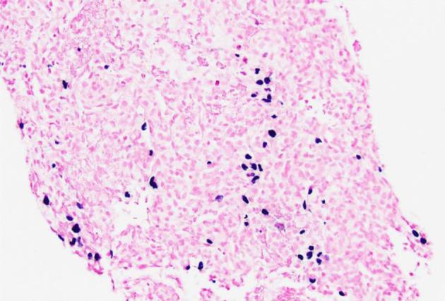 https://cdn.ncbi.nlm.nih.gov/pmc/blobs/6c12/11526580/5ce4ab293b71/jh-13-229-g008.jpg