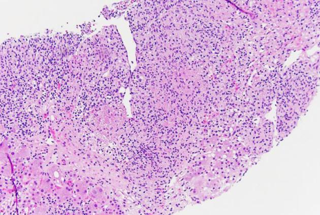 https://cdn.ncbi.nlm.nih.gov/pmc/blobs/6c12/11526580/952fa0cbfdf9/jh-13-229-g009.jpg