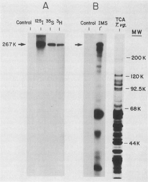 https://cdn.ncbi.nlm.nih.gov/pmc/blobs/6c14/262199/bd29fef98a71/iai00103-0080-a.jpg