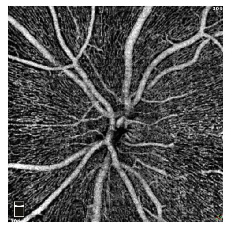 https://cdn.ncbi.nlm.nih.gov/pmc/blobs/6c15/10253578/a2bb8d9fc150/jcm-12-03836-g003.jpg
