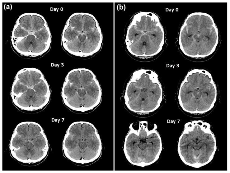 https://cdn.ncbi.nlm.nih.gov/pmc/blobs/6c1d/11434283/9739d700e8cd/medicina-60-01543-g004.jpg