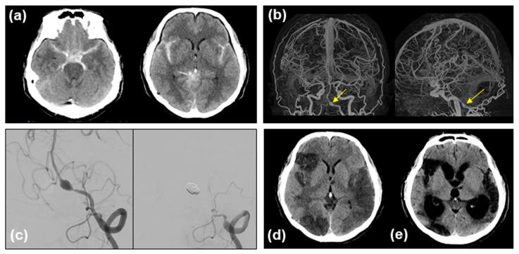 https://cdn.ncbi.nlm.nih.gov/pmc/blobs/6c1d/11434283/c9f3a7814f0e/medicina-60-01543-g001.jpg