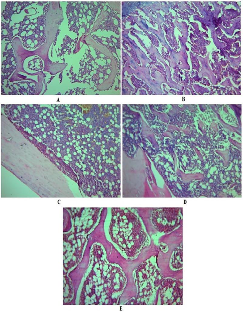 https://cdn.ncbi.nlm.nih.gov/pmc/blobs/6c1f/7808586/a1e21469e648/pone.0240068.g006.jpg