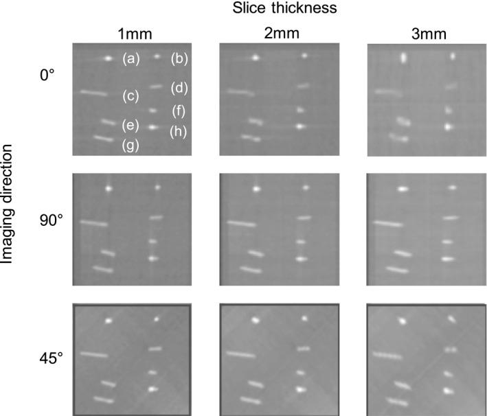 https://cdn.ncbi.nlm.nih.gov/pmc/blobs/6c21/7592977/e2003ae2255b/ACM2-21-151-g005.jpg