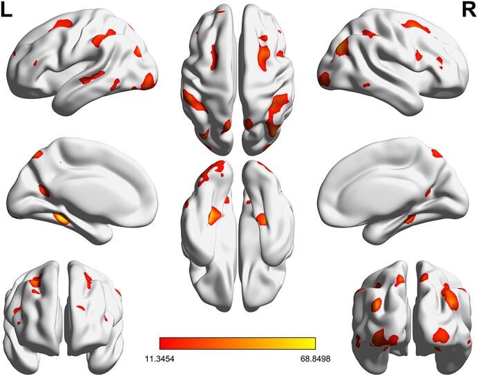 https://cdn.ncbi.nlm.nih.gov/pmc/blobs/6c2a/12202882/933e96f8f1a4/kkaf014fig5.jpg
