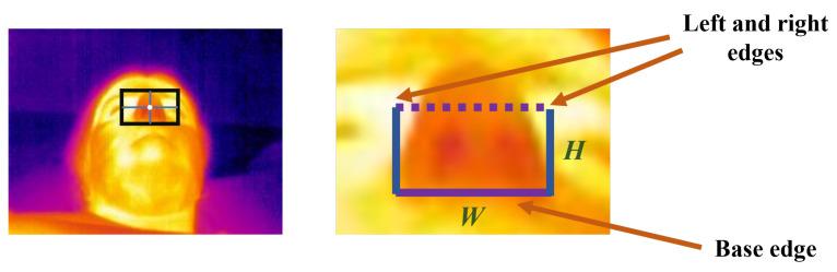 https://cdn.ncbi.nlm.nih.gov/pmc/blobs/6c2b/11679429/80605487ad5a/sensors-24-08118-g003.jpg