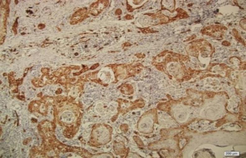 https://cdn.ncbi.nlm.nih.gov/pmc/blobs/6c2d/8801010/de888b2f4675/ijo-34-3-g001.jpg