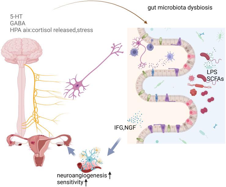 https://cdn.ncbi.nlm.nih.gov/pmc/blobs/6c30/12277312/d138dc829889/fcimb-15-1526063-g004.jpg
