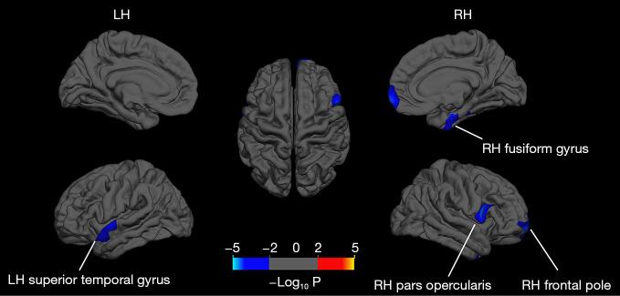 https://cdn.ncbi.nlm.nih.gov/pmc/blobs/6c3a/9403583/bee32ca80552/qims-12-09-4570-f5.jpg