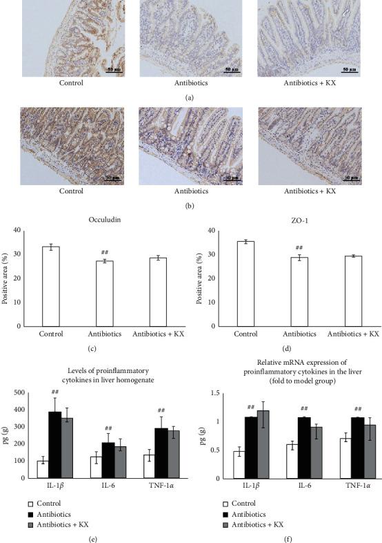 https://cdn.ncbi.nlm.nih.gov/pmc/blobs/6c3c/7596455/a1f2b663a37b/ECAM2020-8890182.006.jpg
