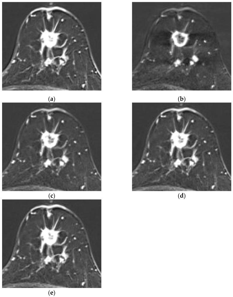 https://cdn.ncbi.nlm.nih.gov/pmc/blobs/6c3f/12346550/a98e9fa372f8/diagnostics-15-01895-g006.jpg