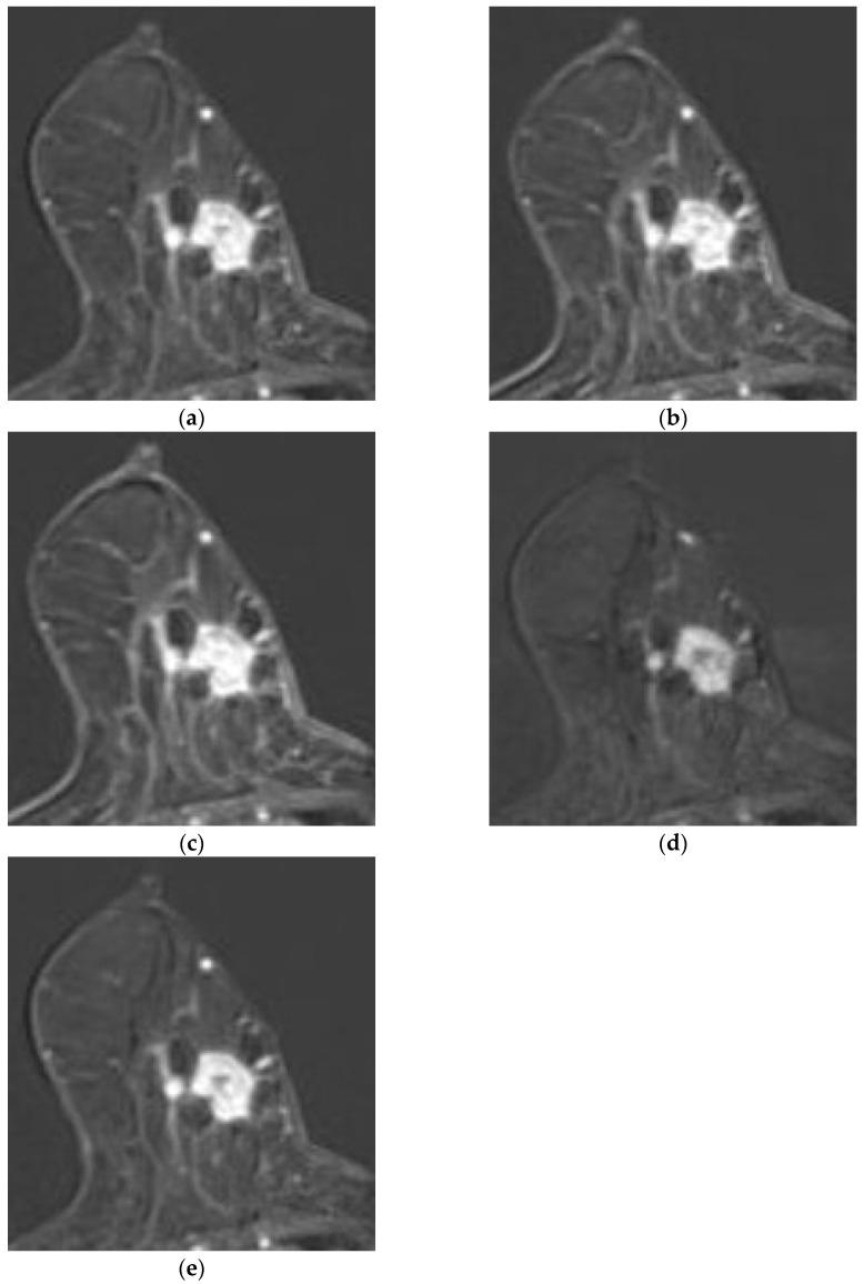 https://cdn.ncbi.nlm.nih.gov/pmc/blobs/6c3f/12346550/b7ee56616d88/diagnostics-15-01895-g005.jpg
