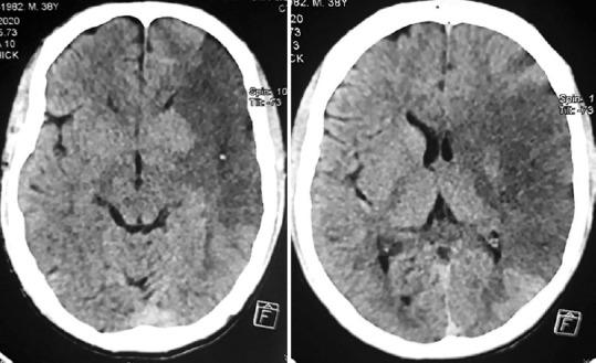 https://cdn.ncbi.nlm.nih.gov/pmc/blobs/6c3f/9215190/c86423837e52/IJABMR-12-130-g003.jpg