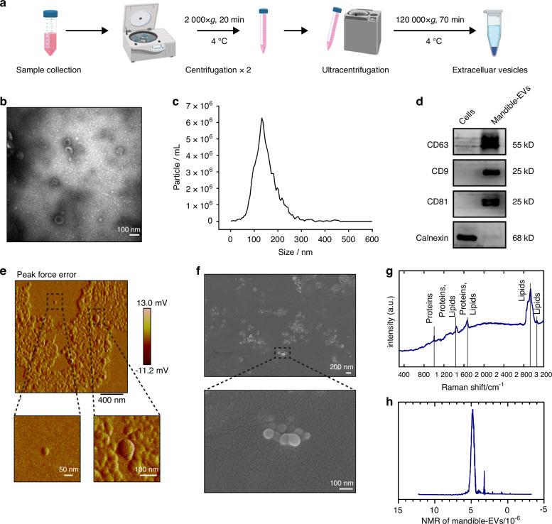 https://cdn.ncbi.nlm.nih.gov/pmc/blobs/6c42/12034755/93a5594232d9/41368_2025_348_Fig1_HTML.jpg