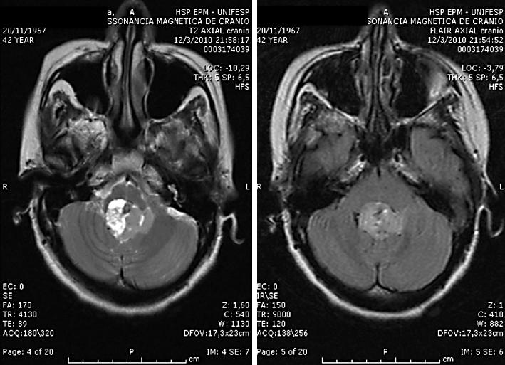 https://cdn.ncbi.nlm.nih.gov/pmc/blobs/6c4a/3072198/0707627a27bf/crn0003-0075-f02.jpg