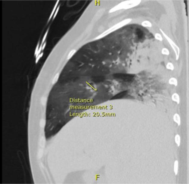 https://cdn.ncbi.nlm.nih.gov/pmc/blobs/6c4e/8565698/994caaf57d3b/acc-07-03-46-g002.jpg