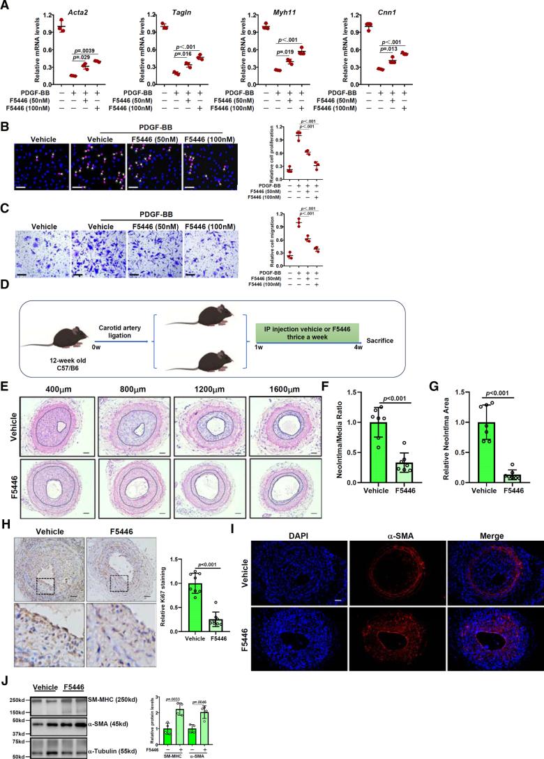 https://cdn.ncbi.nlm.nih.gov/pmc/blobs/6c4f/12094260/82a05420fc1a/atv-45-965-g003.jpg
