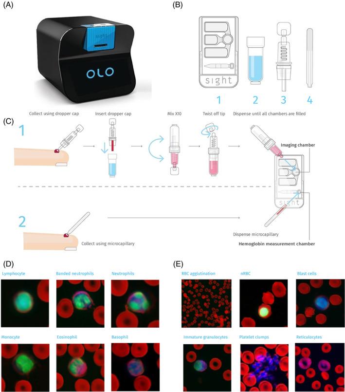 https://cdn.ncbi.nlm.nih.gov/pmc/blobs/6c4f/9290600/f6a65753358a/AJH-96-1264-g002.jpg