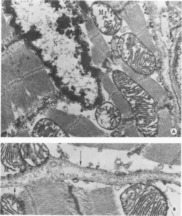 https://cdn.ncbi.nlm.nih.gov/pmc/blobs/6c65/2018580/1344112f5f0f/amjpathol00735-0221-a.jpg