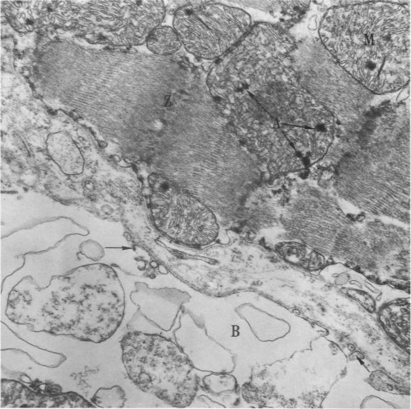 https://cdn.ncbi.nlm.nih.gov/pmc/blobs/6c65/2018580/3bbfa90f76e9/amjpathol00735-0222-a.jpg