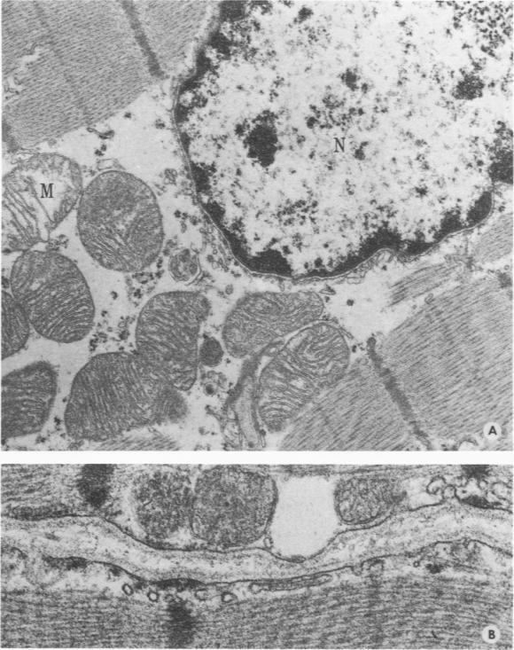 https://cdn.ncbi.nlm.nih.gov/pmc/blobs/6c65/2018580/7c6cd7595d4c/amjpathol00735-0220-a.jpg