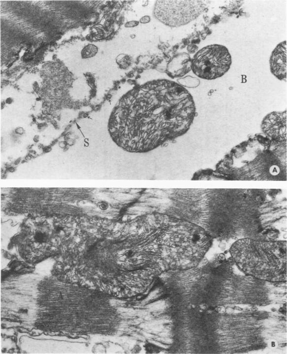 https://cdn.ncbi.nlm.nih.gov/pmc/blobs/6c65/2018580/d8df3b54ff88/amjpathol00735-0223-a.jpg