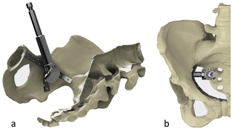 https://cdn.ncbi.nlm.nih.gov/pmc/blobs/6c66/10390178/fc6f15f6ce68/turkjmedsci-52-3-816f7.jpg