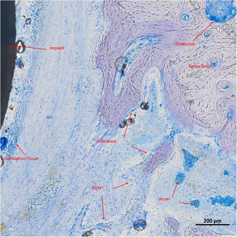 https://cdn.ncbi.nlm.nih.gov/pmc/blobs/6c66/11976354/39073a77d0a8/784_2025_6303_Fig4_HTML.jpg