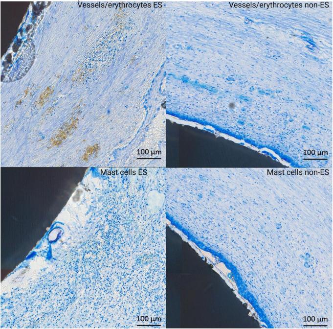 https://cdn.ncbi.nlm.nih.gov/pmc/blobs/6c66/11976354/63b8c5e3f8df/784_2025_6303_Fig7_HTML.jpg