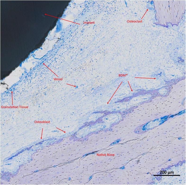 https://cdn.ncbi.nlm.nih.gov/pmc/blobs/6c66/11976354/d25e91d82a93/784_2025_6303_Fig5_HTML.jpg