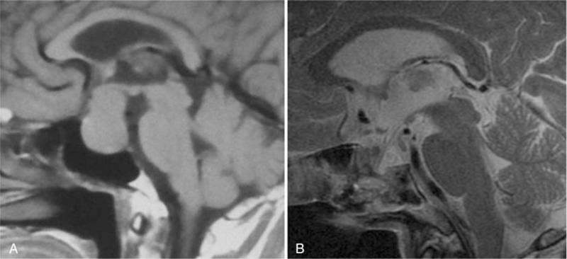 https://cdn.ncbi.nlm.nih.gov/pmc/blobs/6c67/6392657/951834abf922/medi-96-e9422-g007.jpg
