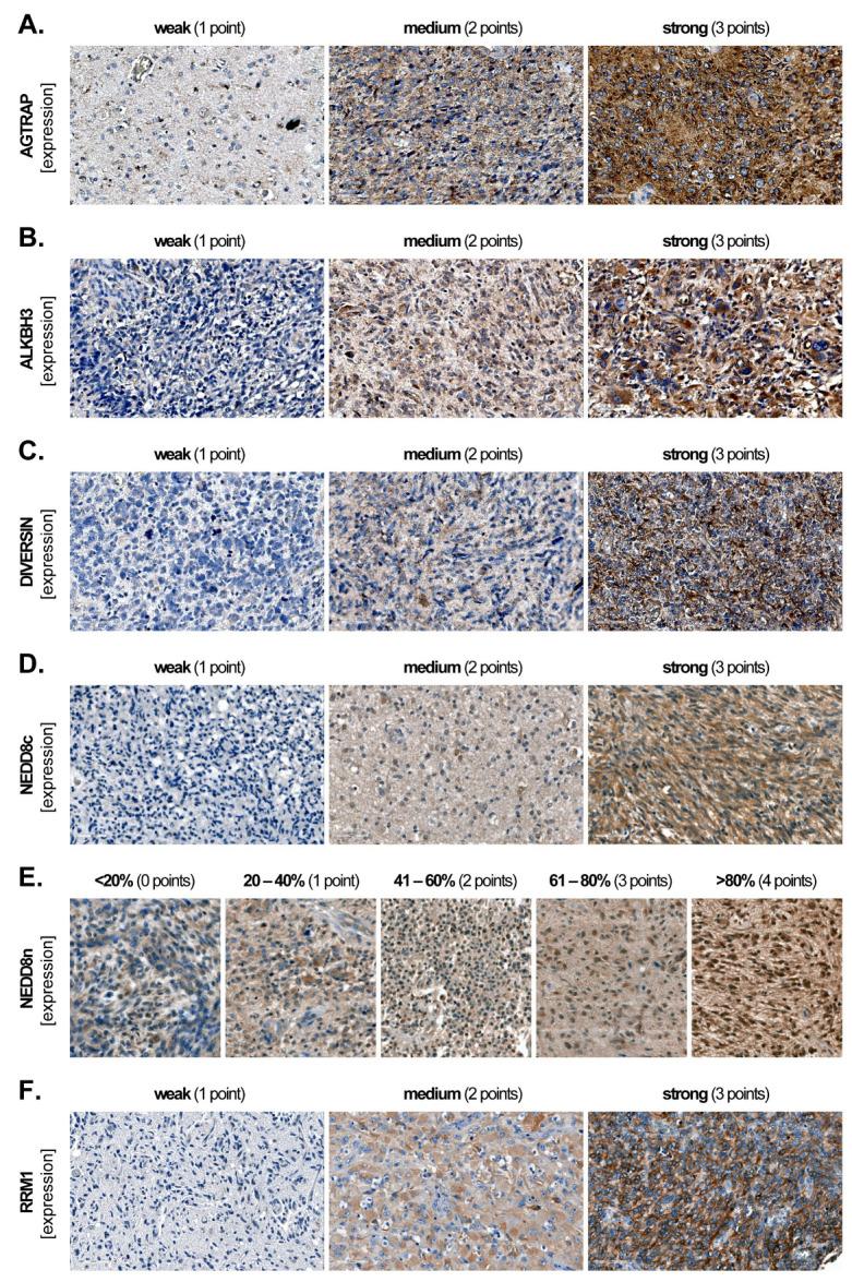 https://cdn.ncbi.nlm.nih.gov/pmc/blobs/6c68/11048029/79c109ef1c77/biomedicines-12-00926-g001.jpg