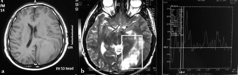 https://cdn.ncbi.nlm.nih.gov/pmc/blobs/6c69/3011111/857861f892e8/SNI-1-87-g002.jpg