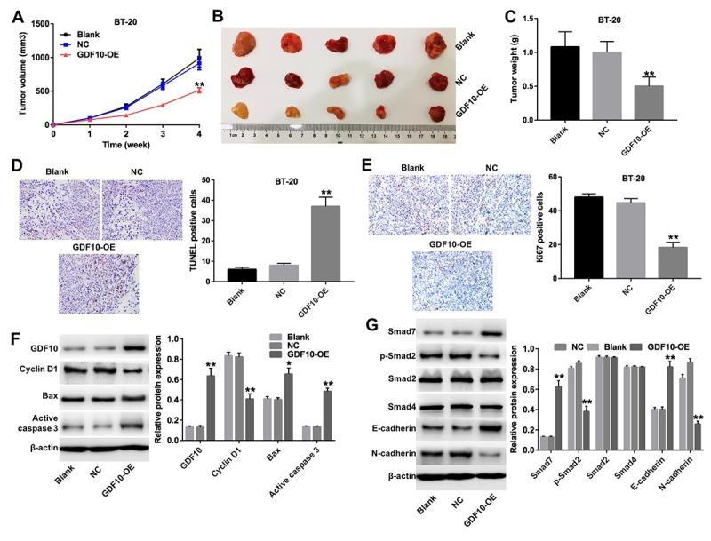 https://cdn.ncbi.nlm.nih.gov/pmc/blobs/6c6b/6555447/40c31e75fcbb/aging-11-101983-g006.jpg