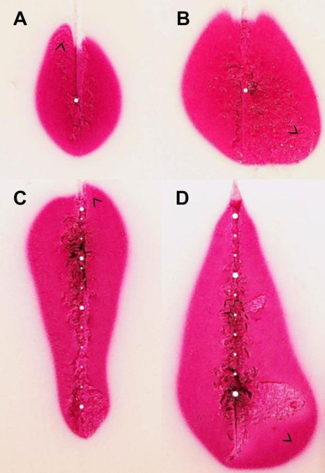 https://cdn.ncbi.nlm.nih.gov/pmc/blobs/6c6f/11695216/086ddacf570a/fonc-14-1463686-g007.jpg