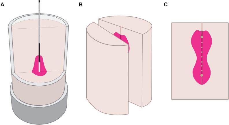 https://cdn.ncbi.nlm.nih.gov/pmc/blobs/6c6f/11695216/b968a5f32c2e/fonc-14-1463686-g003.jpg