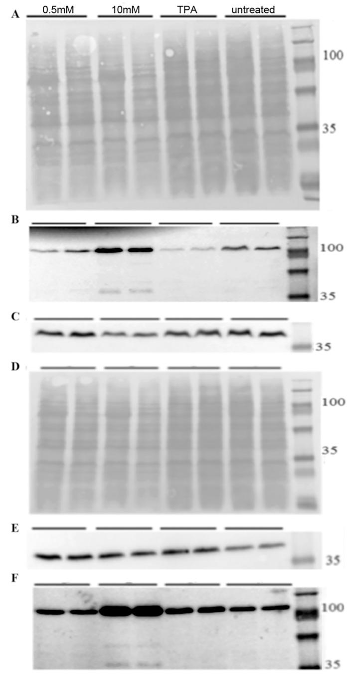 https://cdn.ncbi.nlm.nih.gov/pmc/blobs/6c74/4956219/94d17ff02c25/pone.0154102.g008.jpg