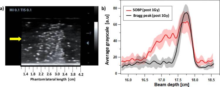https://cdn.ncbi.nlm.nih.gov/pmc/blobs/6c77/9107472/f1ecab0ee0ad/41598_2022_11524_Fig5_HTML.jpg