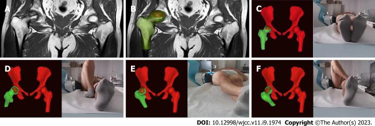 https://cdn.ncbi.nlm.nih.gov/pmc/blobs/6c78/10044968/7912c2616d2f/WJCC-11-1974-g001.jpg