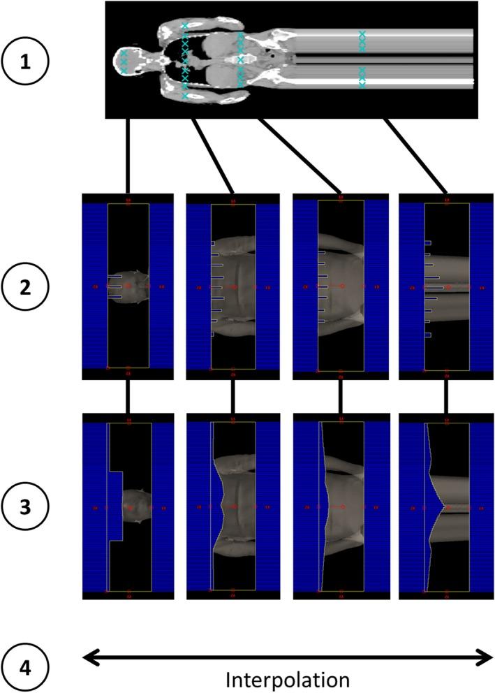 https://cdn.ncbi.nlm.nih.gov/pmc/blobs/6c78/7075390/4106091a65be/ACM2-21-75-g006.jpg