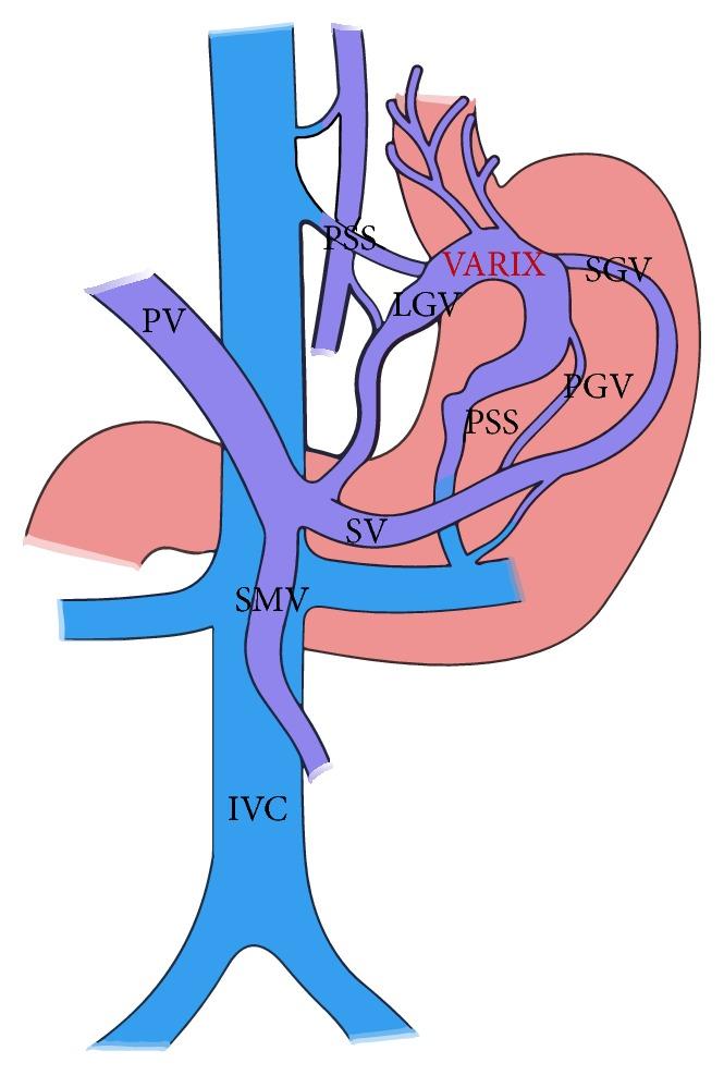 https://cdn.ncbi.nlm.nih.gov/pmc/blobs/6c7a/5198179/4ba54005f3aa/IJH2016-6170243.003.jpg