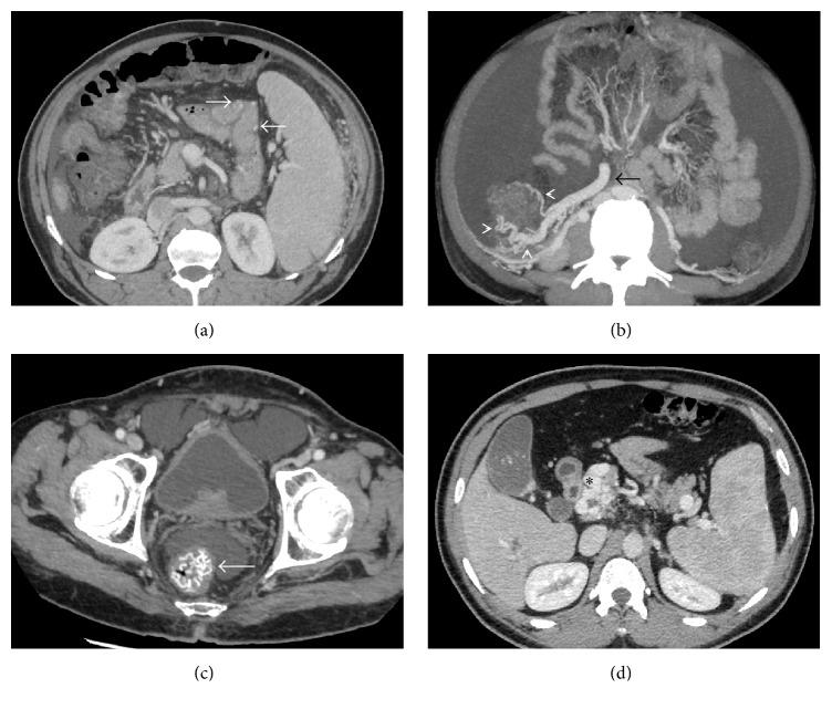 https://cdn.ncbi.nlm.nih.gov/pmc/blobs/6c7a/5198179/9a69c59aeaf2/IJH2016-6170243.006.jpg