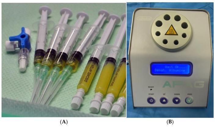 https://cdn.ncbi.nlm.nih.gov/pmc/blobs/6c7c/11767021/53645ce7b369/medicina-61-00084-g002.jpg