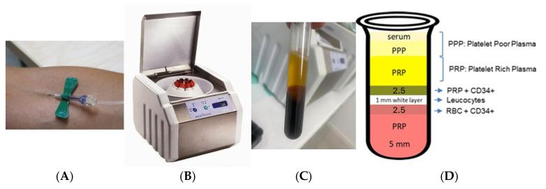 https://cdn.ncbi.nlm.nih.gov/pmc/blobs/6c7c/11767021/870df2932934/medicina-61-00084-g001.jpg