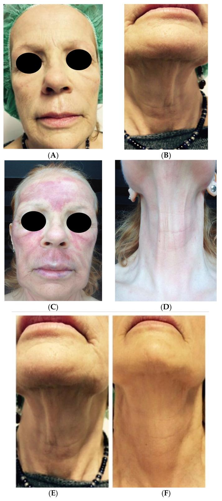 https://cdn.ncbi.nlm.nih.gov/pmc/blobs/6c7c/11767021/cfb12fce2239/medicina-61-00084-g006a.jpg