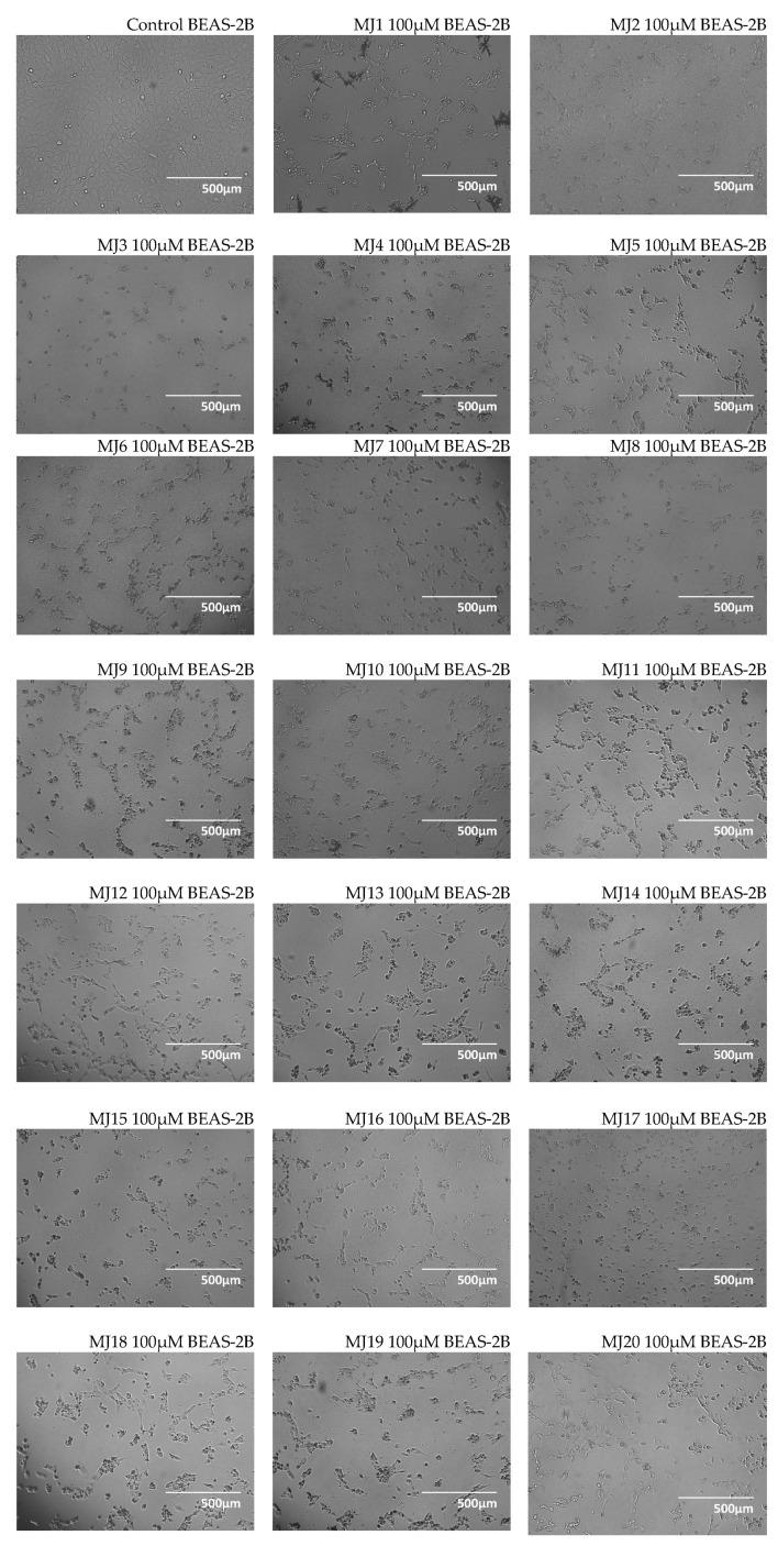 https://cdn.ncbi.nlm.nih.gov/pmc/blobs/6c7e/12295927/3fbd17ce8008/ijms-26-06920-g001.jpg
