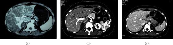 https://cdn.ncbi.nlm.nih.gov/pmc/blobs/6c7f/10547568/7253bad9c3df/IJE2023-6686168.001.jpg