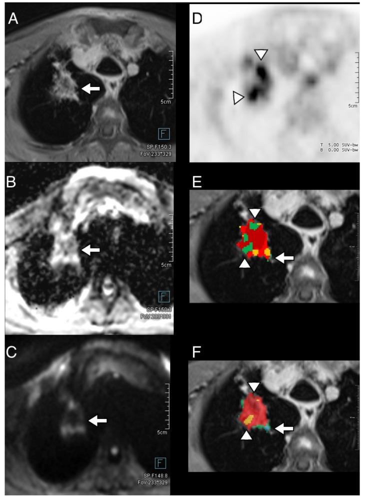 https://cdn.ncbi.nlm.nih.gov/pmc/blobs/6c7f/11353375/32a6e3eb7cc9/diagnostics-14-01787-g005.jpg