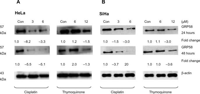 https://cdn.ncbi.nlm.nih.gov/pmc/blobs/6c84/4132255/a9f415c8dd4e/ott-7-1375Fig4.jpg